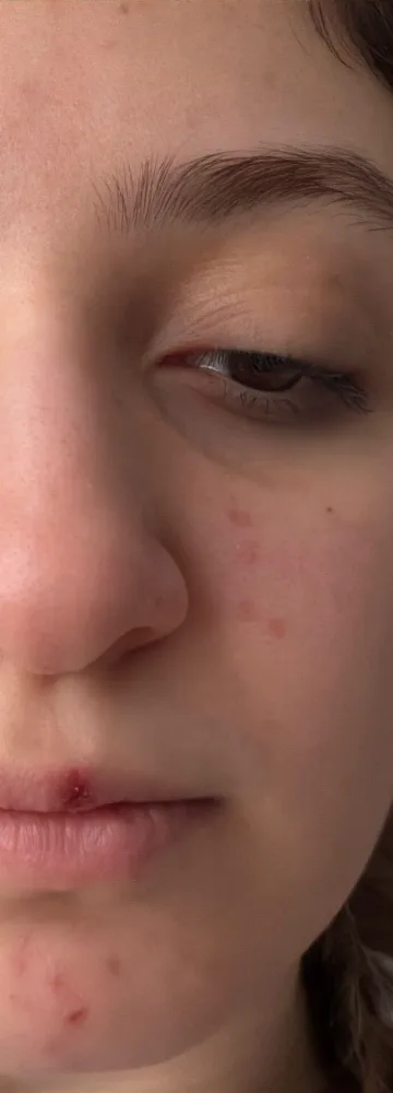 قبل