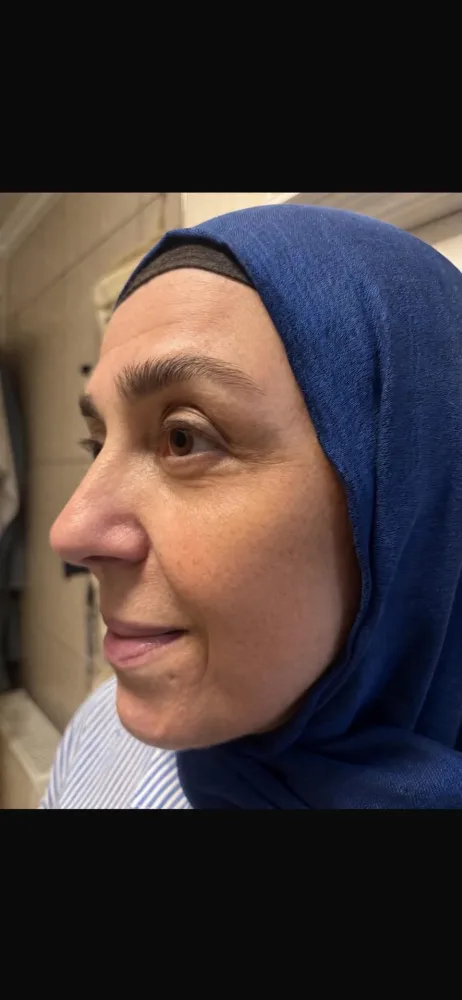 بعد